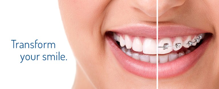 ORTHODONTIC