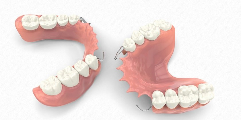 replacement of teeth